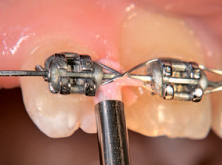 Полировальная щетка NTI - фото 1